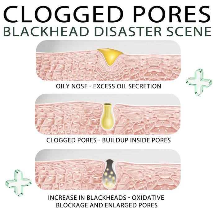 Blackhead Remover Tools -15g Blackhead Creamwith 40Pcs Blackhead Pore Strips